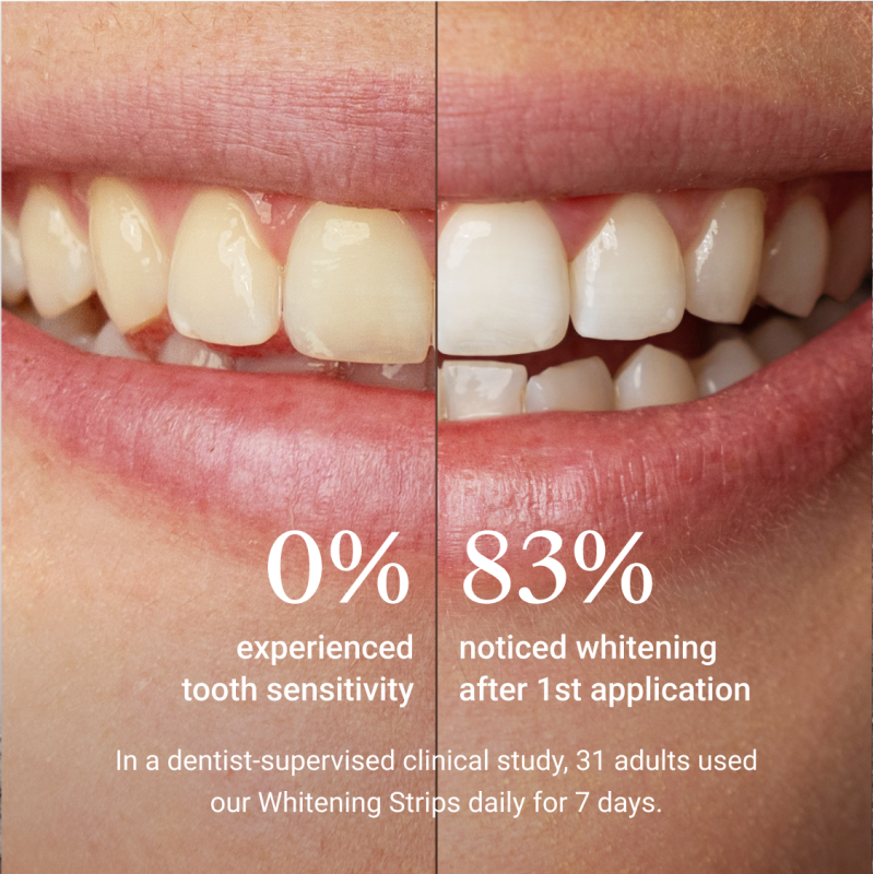 Whitening Strips – hammaste valgendamise ribad, 7 paari