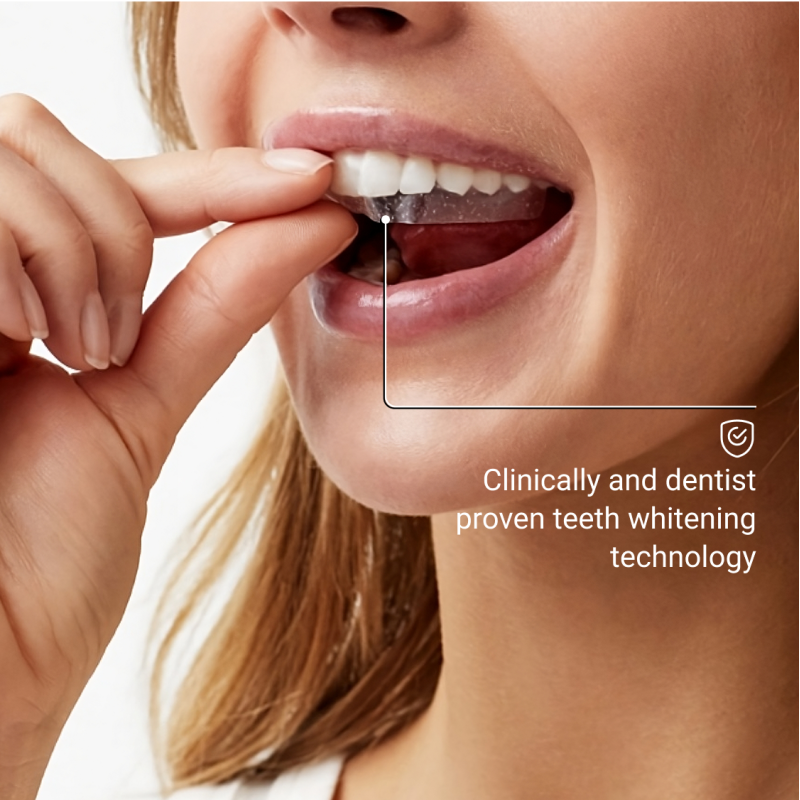 Whitening Strips Sensitive – hammaste valgendamise ribad tundlikele hammastele, 7 paari