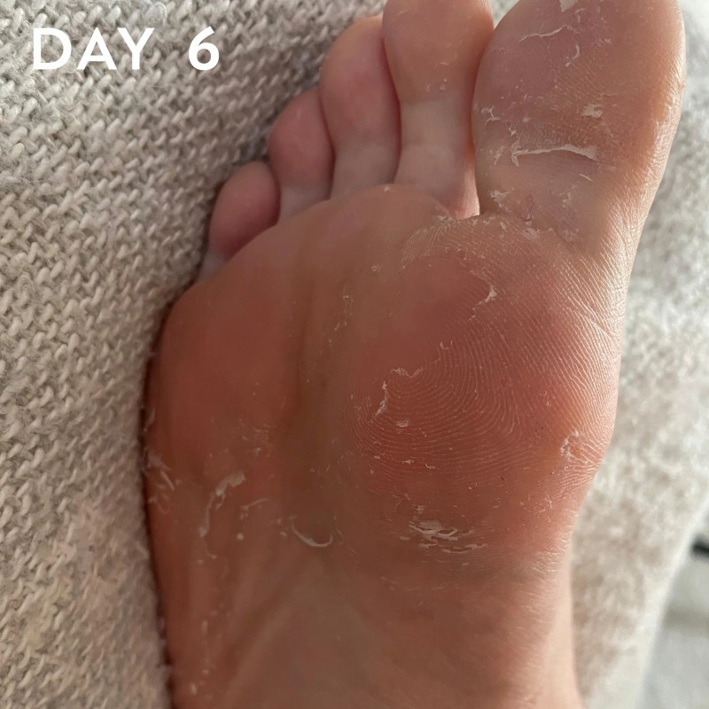 FOOT PEEL Professional Foot Treatment Jalgu kooriv mask–sokid, 1 paar