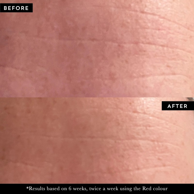 PHOTON LED Light Therapy Face Mask LED näomask, 1 tk